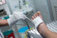 An Overview of Diabetic Foot Ulcers 